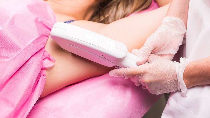 épilation définitive aisselles