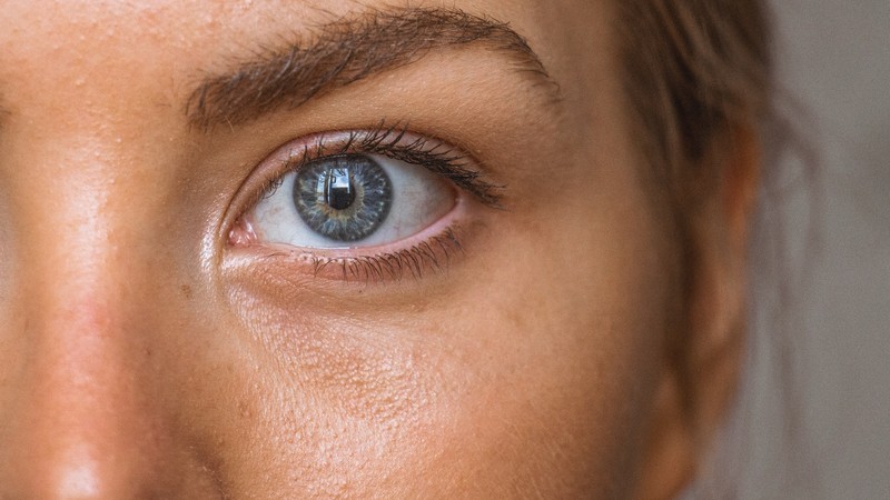 Se débarrasser des pores dilatés